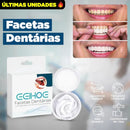 Nature Smile® - Facetas Dentárias Removíveis