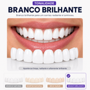 ProSmile NaturalFit™ — Faceta Dentária Ajustável