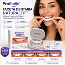 ProSmile NaturalFit™ — Faceta Dentária Ajustável